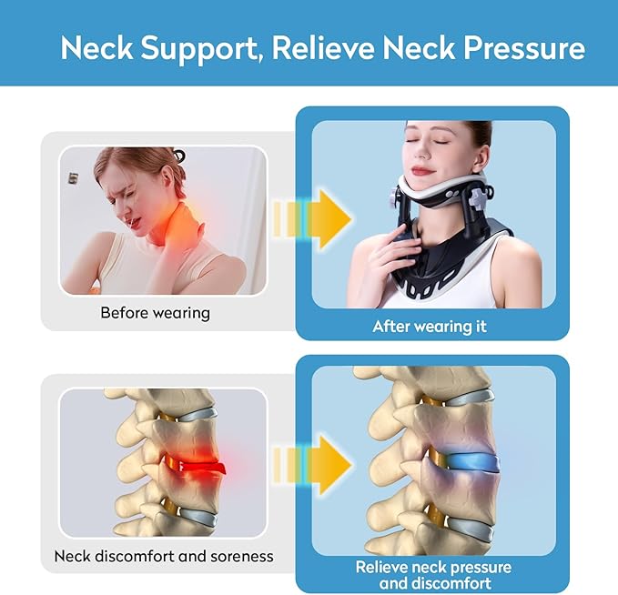 Neck Stretcher